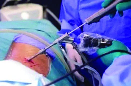 Surgeon operating under the endoscope